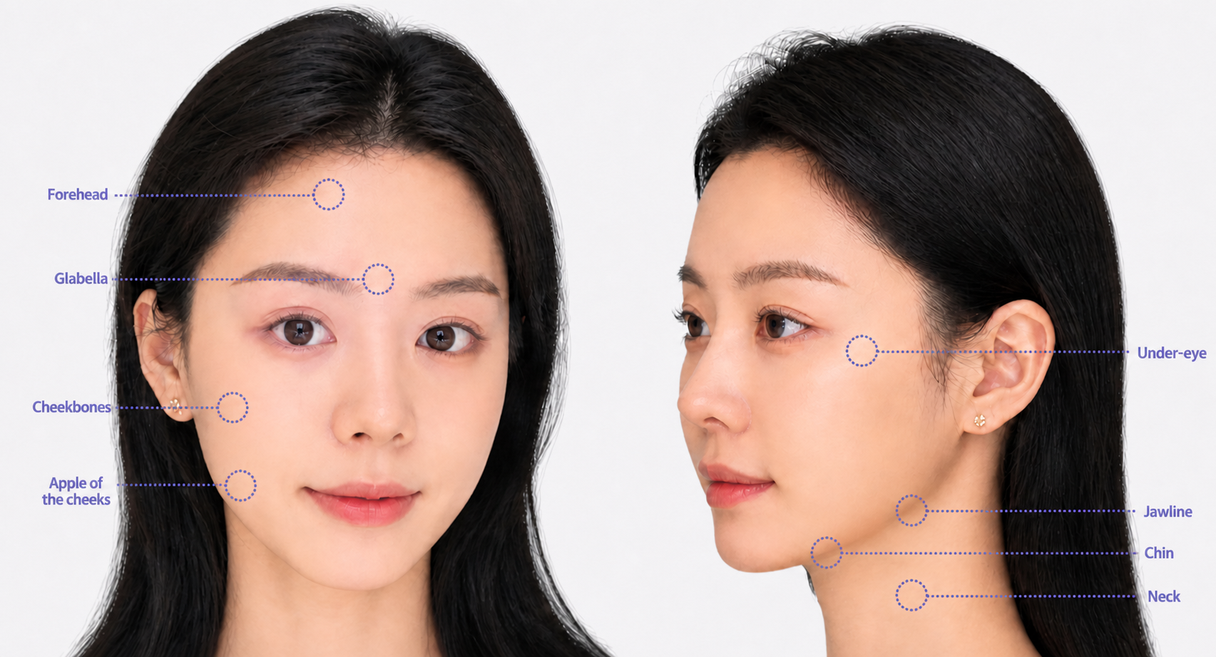 Alltite treatment areas — forehead, glabella, cheekbones, cheeks, eye area, jawline, double chin, neck