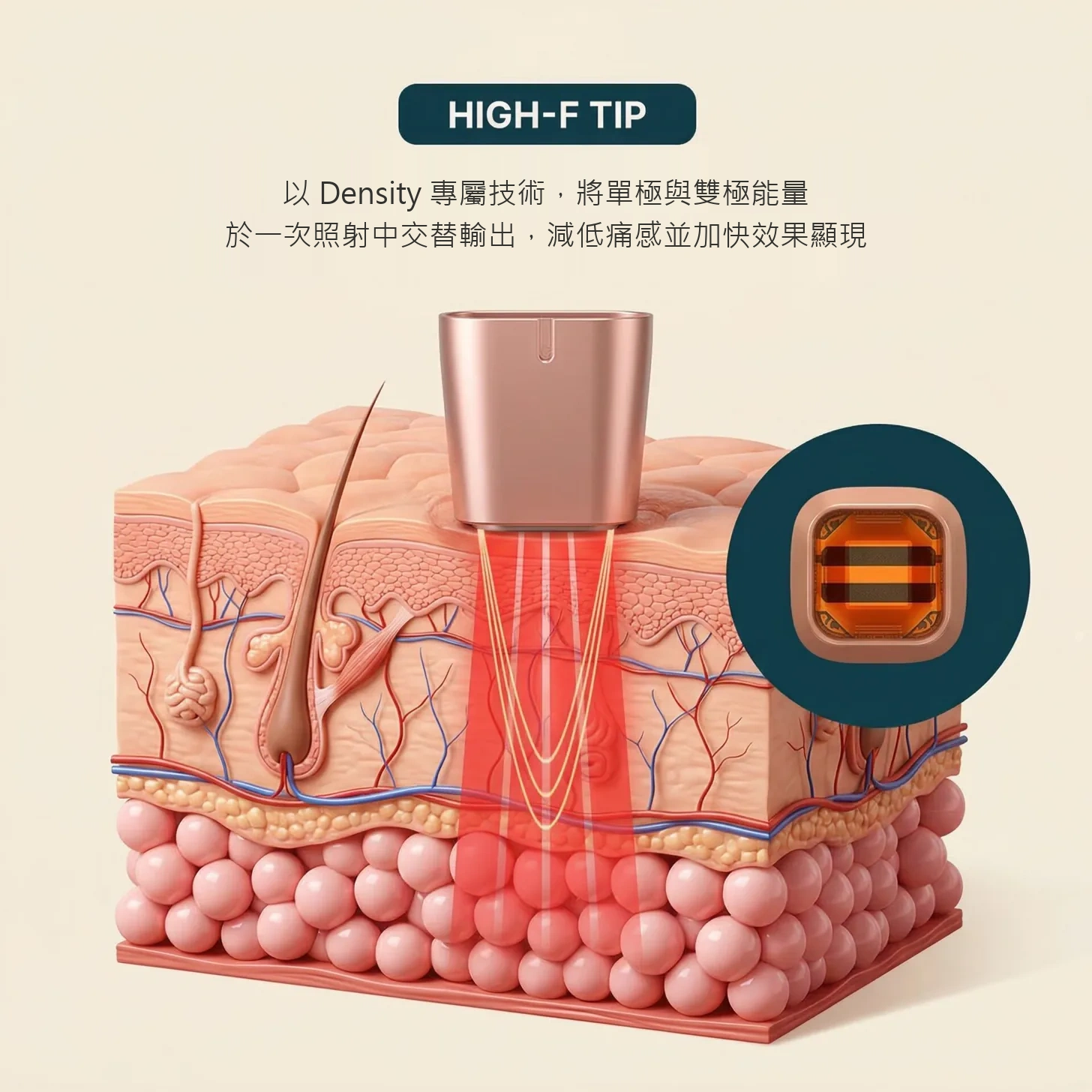 High探頭