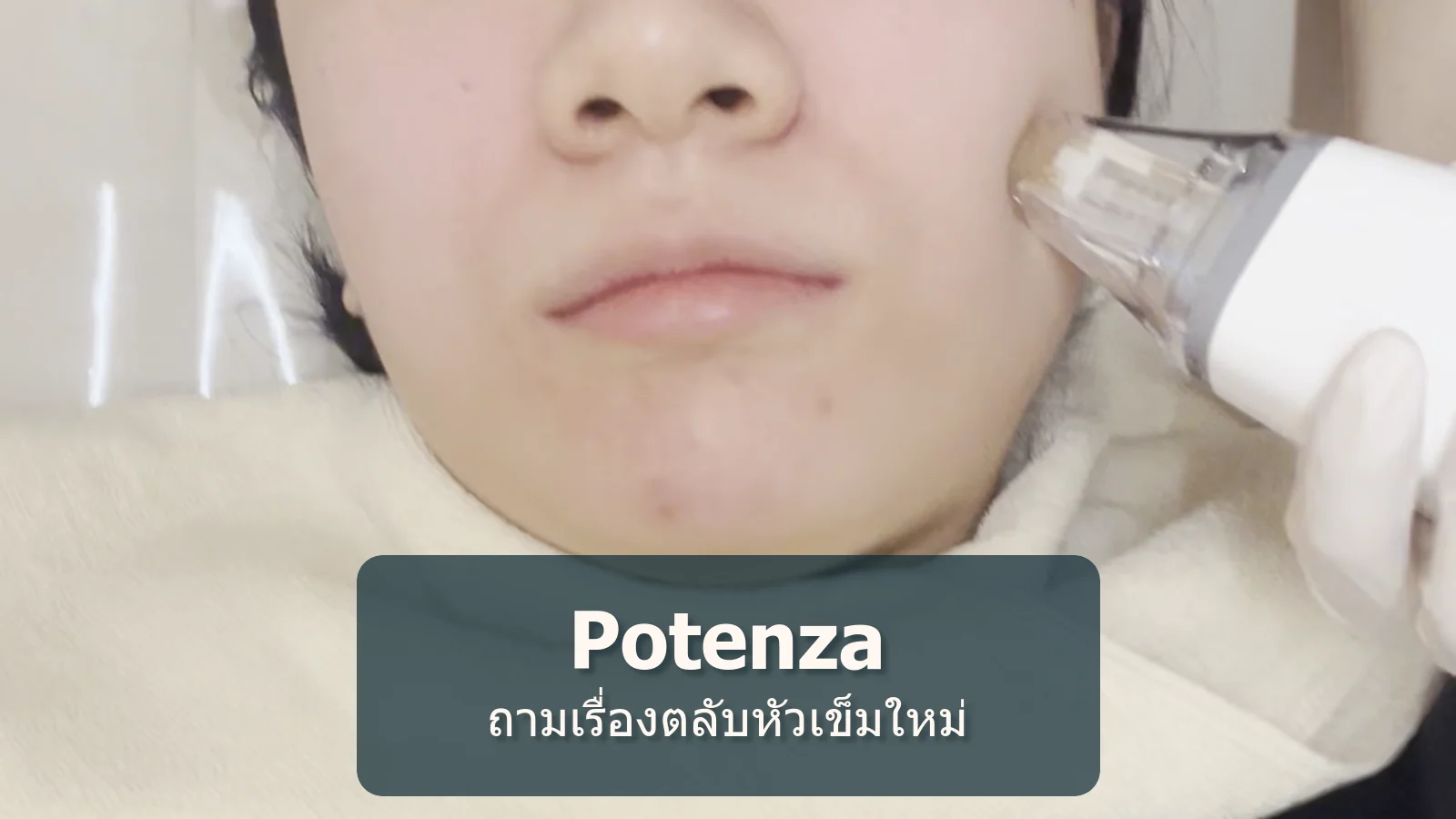 ก่อนทำ Potenza ควรถามเรื่องหัวเข็มใหม่และการป้องกันการติดเชื้ออย่างไร