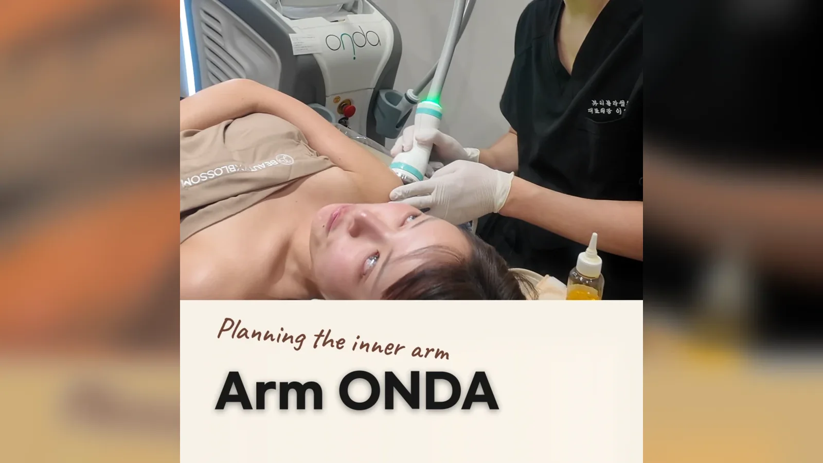 Upper-Arm ONDA in Seoul: How Is the Area Mapped?