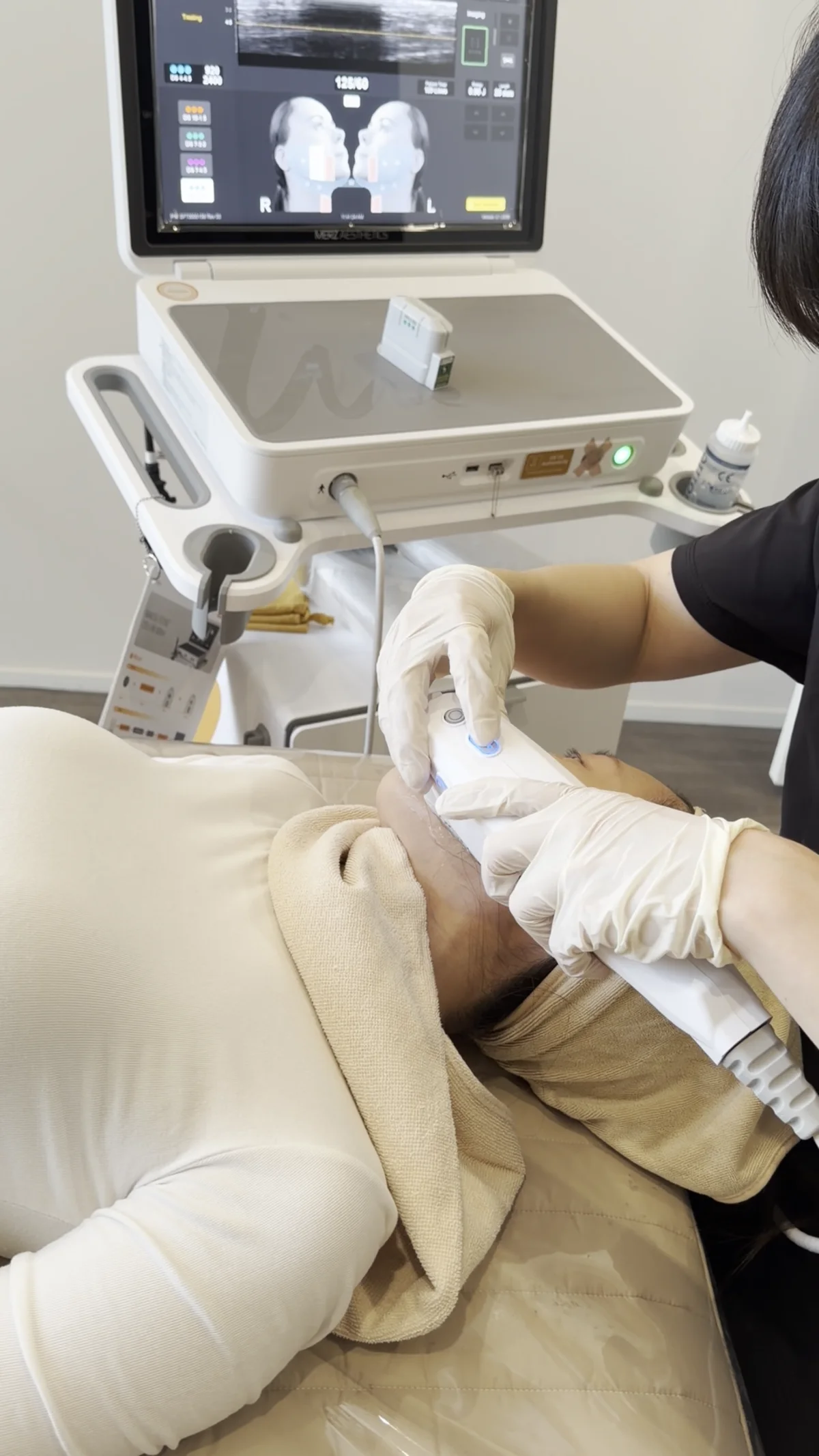 Ultherapy handpiece held against the skin along a person's jawline and under-chin area