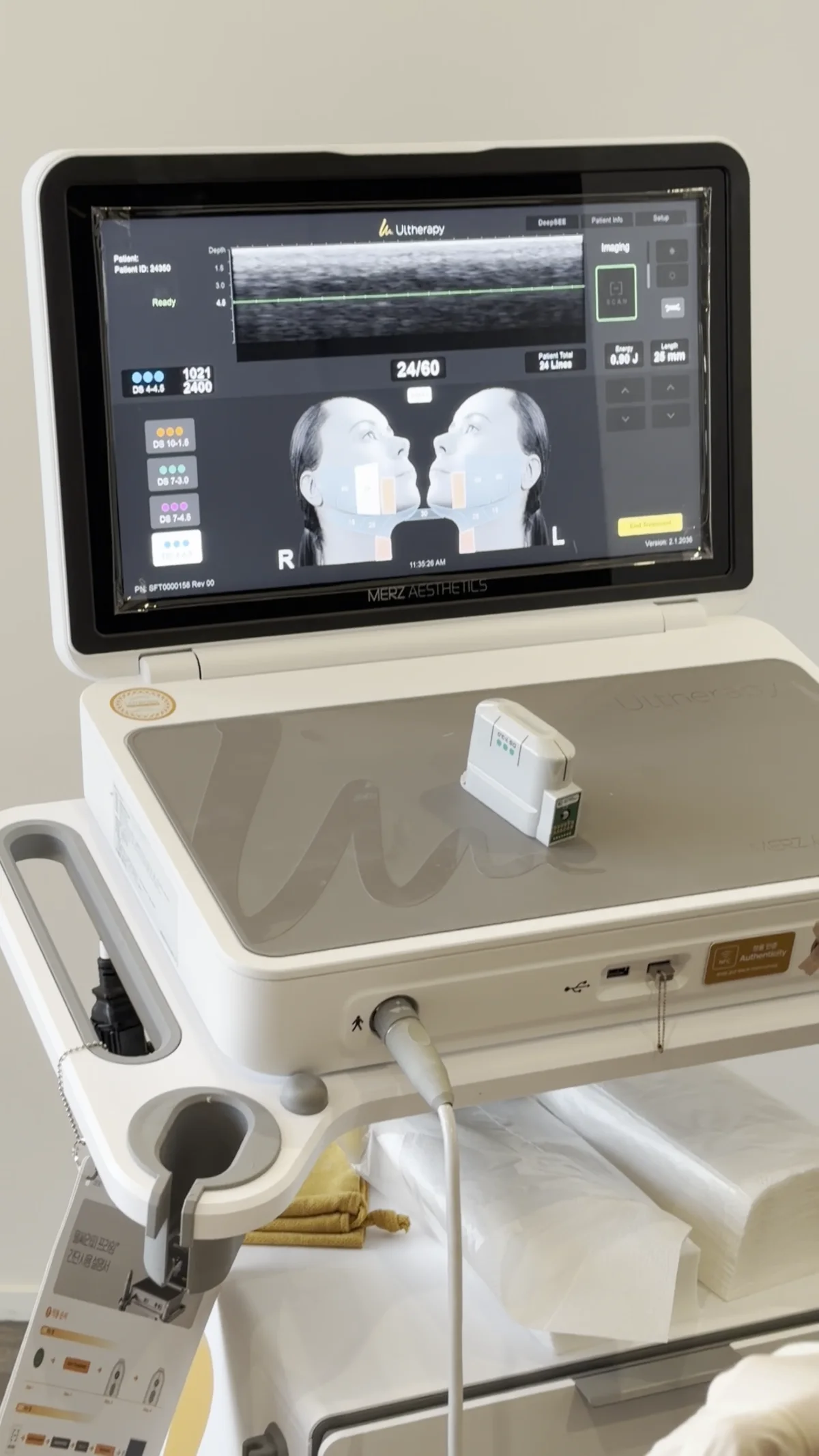 Ultherapy Prime console with an ultrasound image on its screen
