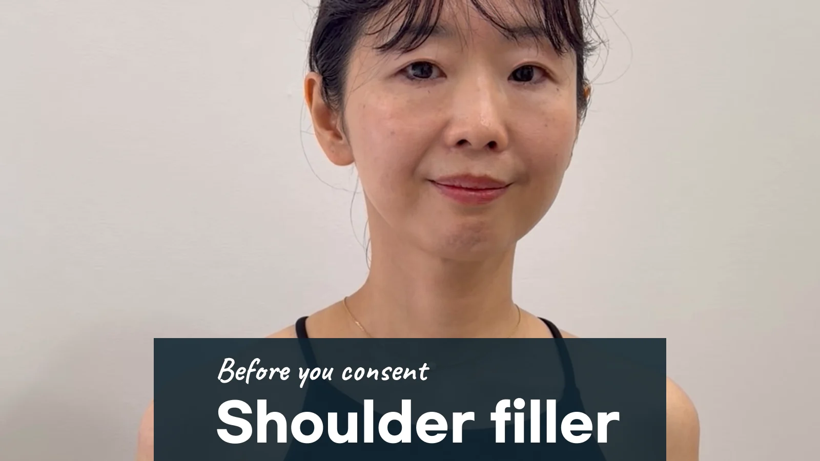 Shoulder filler: what safety details should you confirm first?