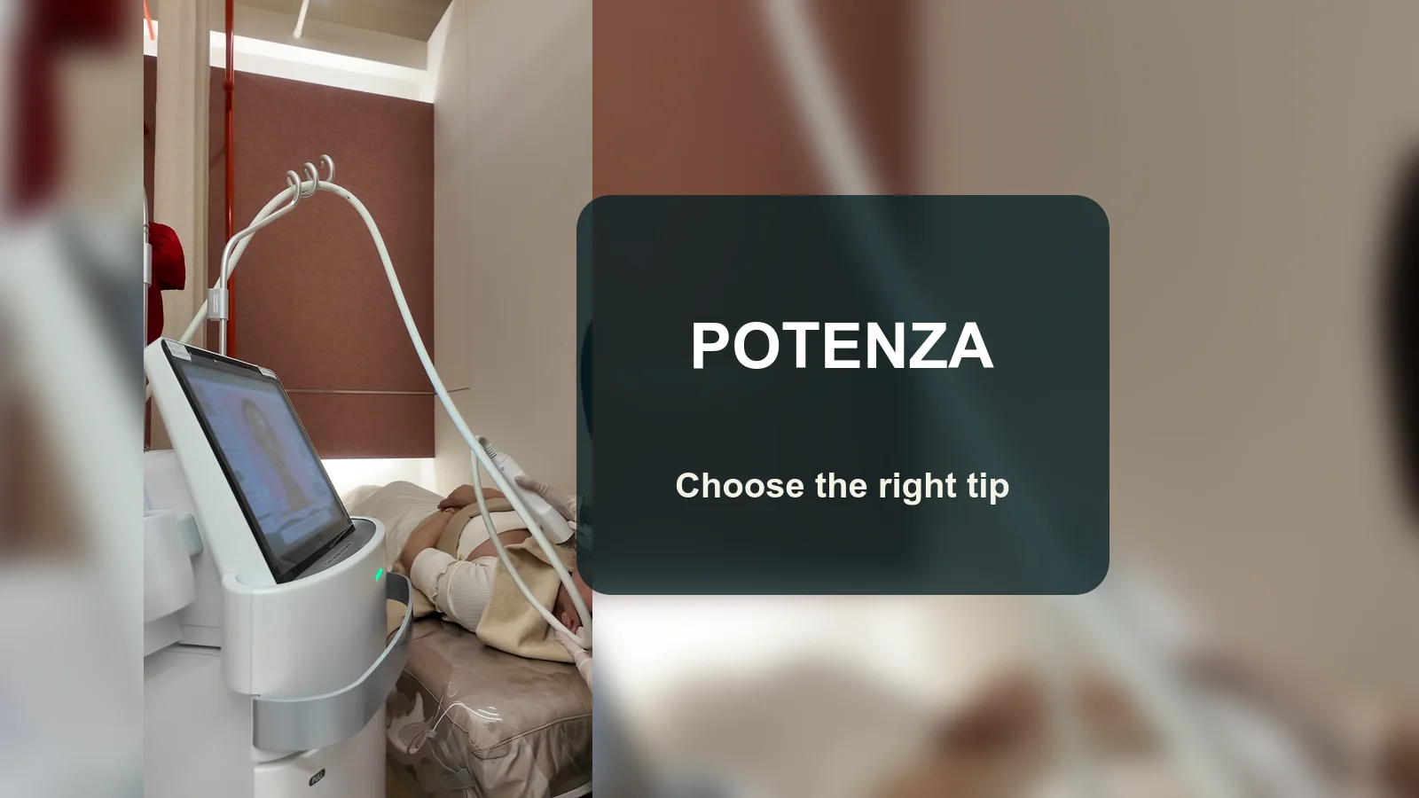 Potenza Tips: When Is Microneedle RF Different from Surface RF?