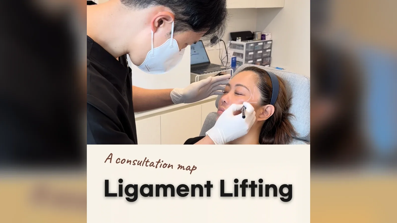 Retaining Ligament Lift: Which Facial Areas Are Assessed?
