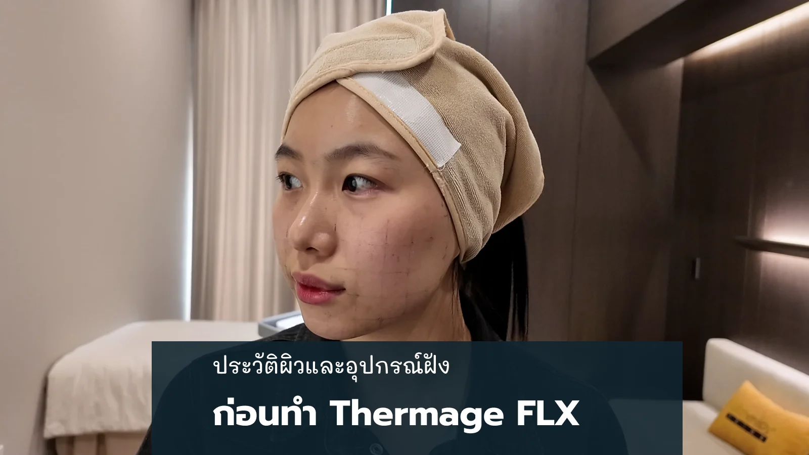 ก่อนทำ Thermage FLX ควรเล่าเรื่องผิวและอุปกรณ์ฝังอะไรบ้าง