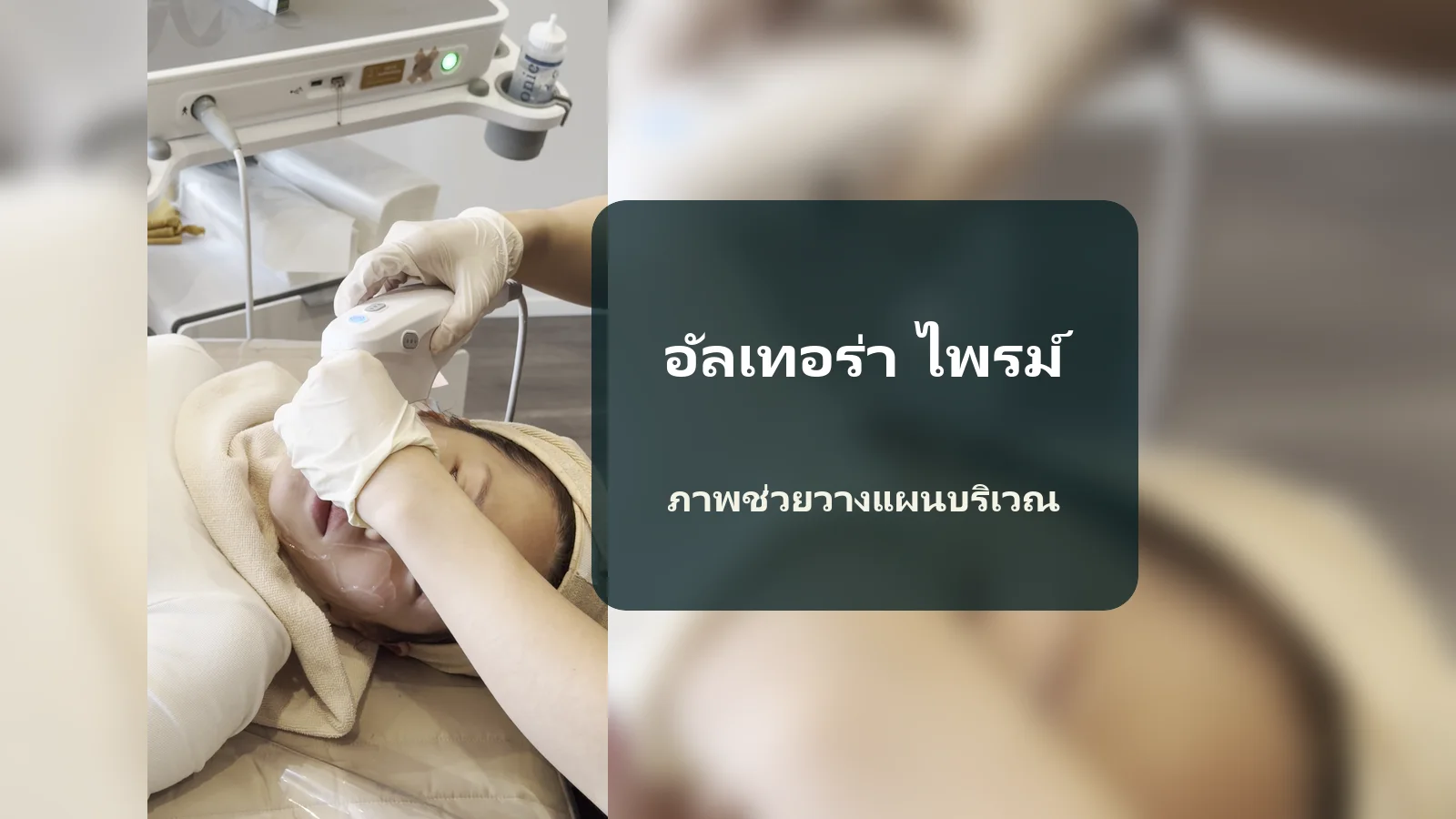 ภาพอัลตราซาวนด์ของ Ultherapy Prime ช่วยคุยเรื่องบริเวณที่ทำอย่างไร?