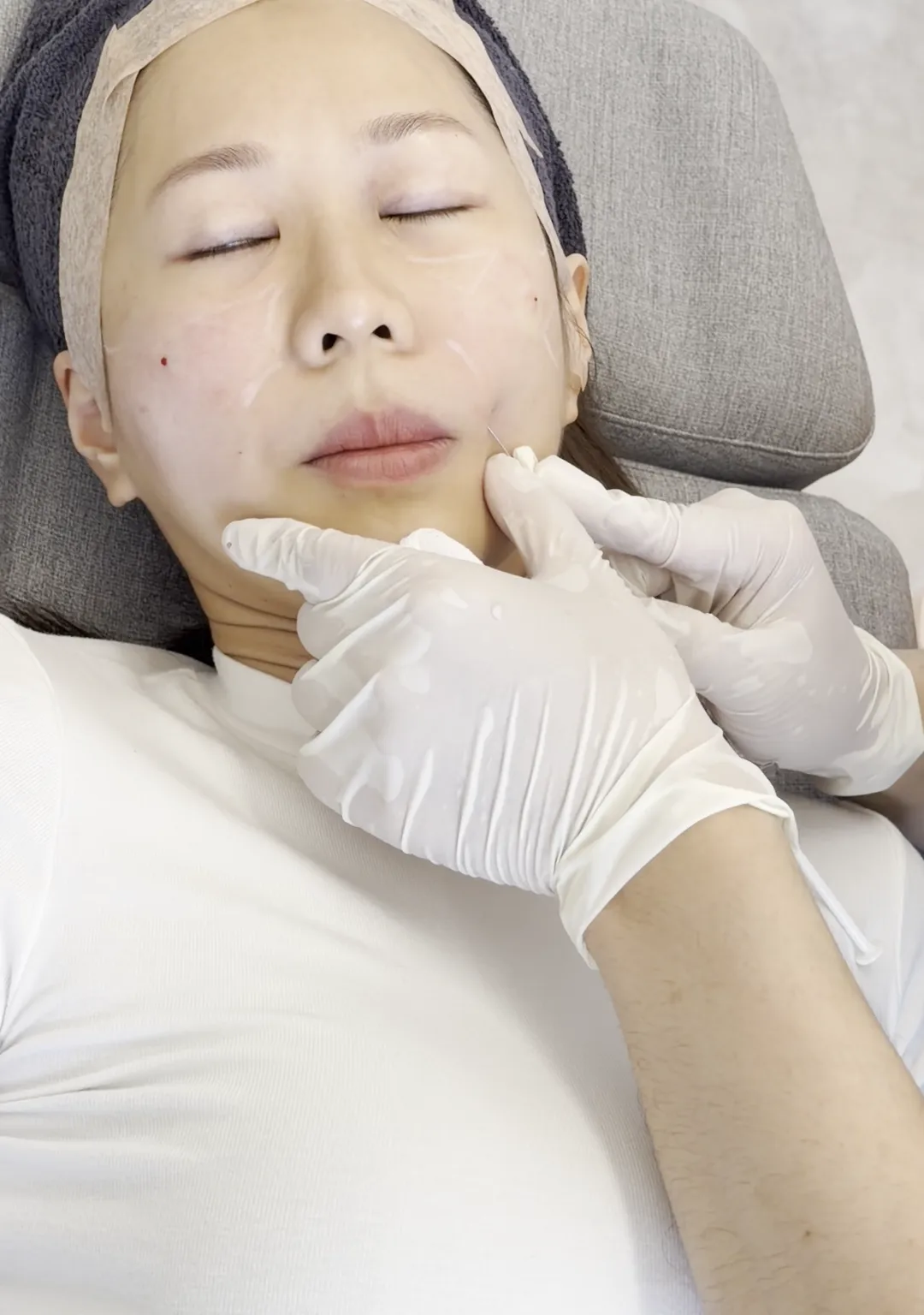 Woman reclining with eyes closed while gloved hands touch her jaw