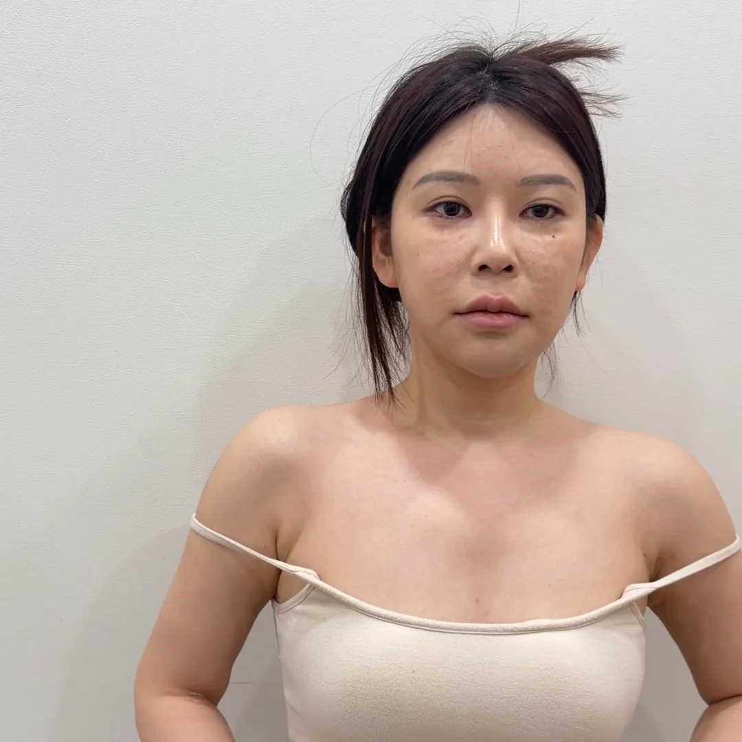 Standing front view showing both shoulders and collarbones
