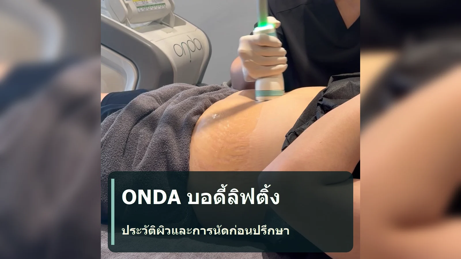 ONDA บอดี้ลิฟติ้ง: ประวัติหัตถการ อาการผิวที่เคยเกิด และการวางแผนนัด ควรบอกอะไรก่อนปรึกษา