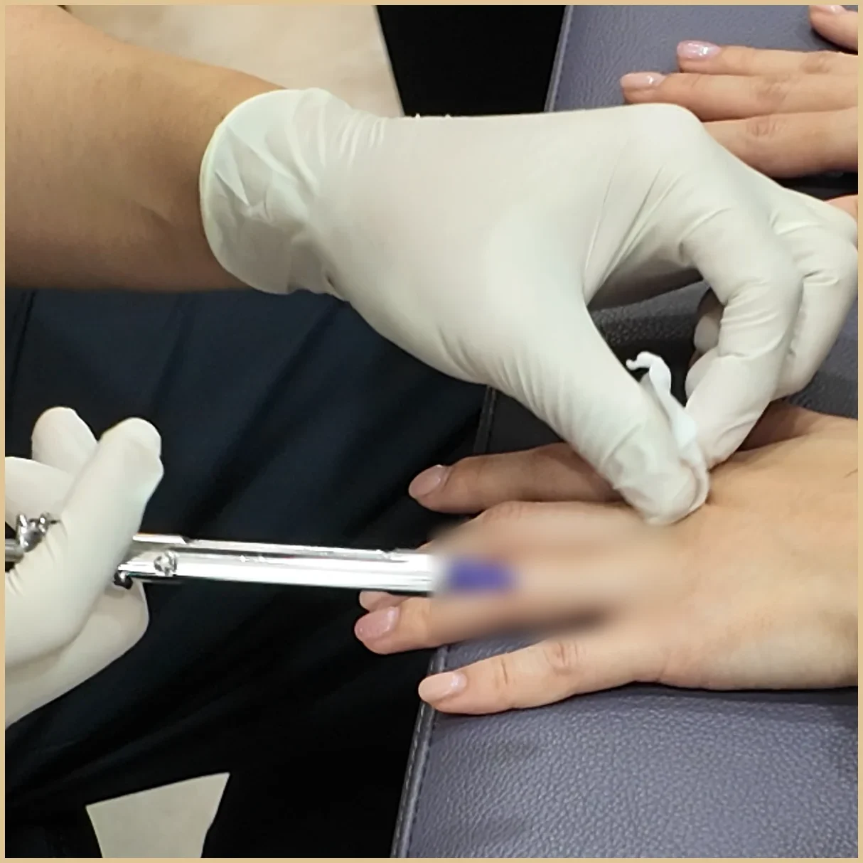 Gloved hands demonstrating an injection technique on a hand in an illustrative clinic demo