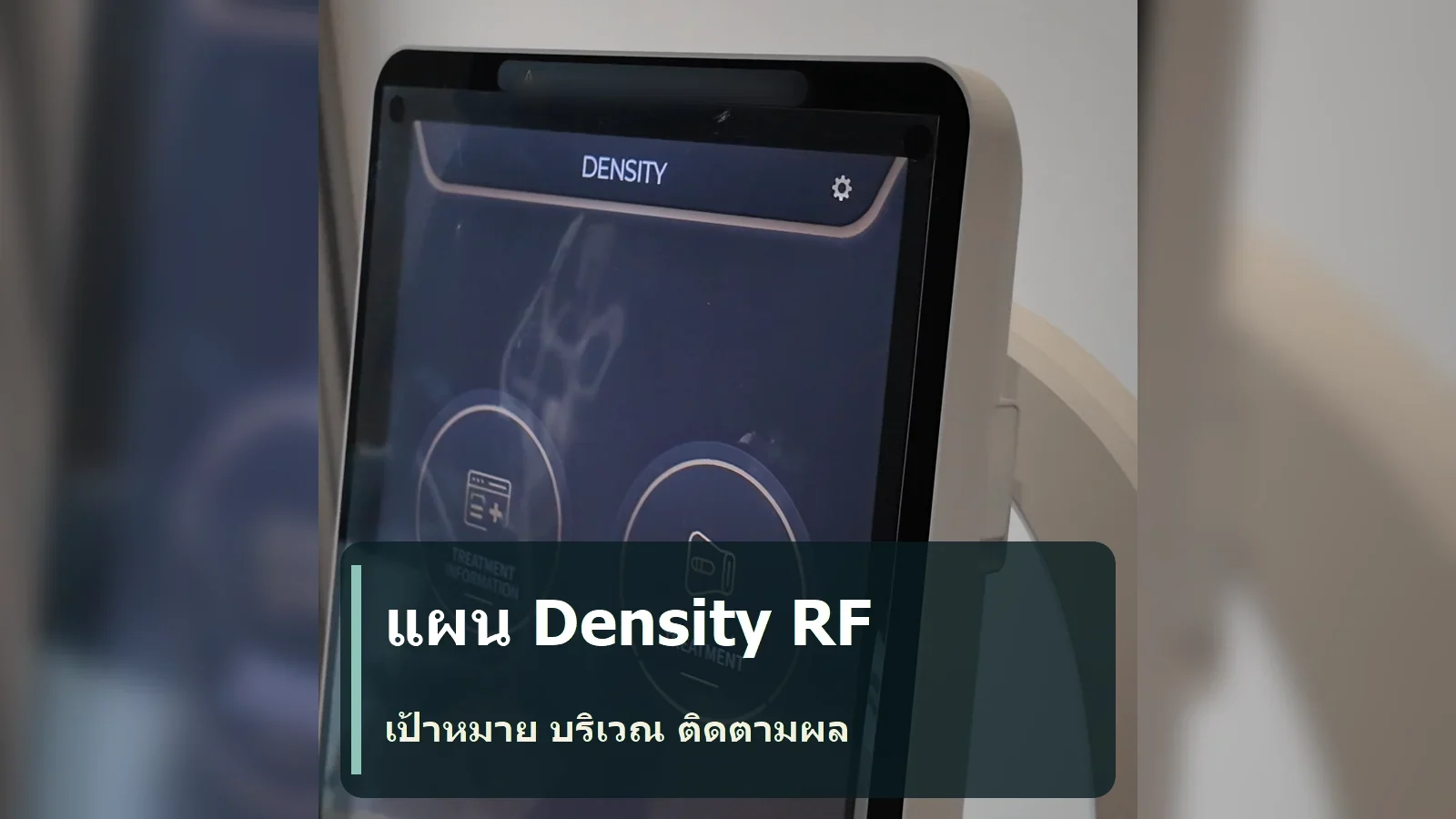 แผนการรักษาเดนซิตี้ (Density) RF คือบันทึกเป้าหมายและการติดตามผล ไม่ใช่คำสัญญา