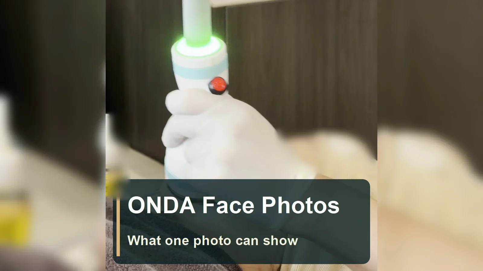 ONDA Facial Treatment Photos: What the Cart, Handpiece and Treated Area Can Show, and What They Cannot