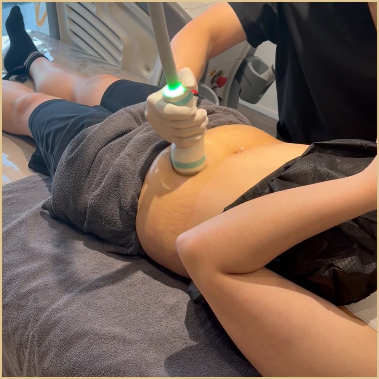 A gloved hand holding a handpiece with a green light on the abdomen of a person lying down, with part of a treatment device visible behind