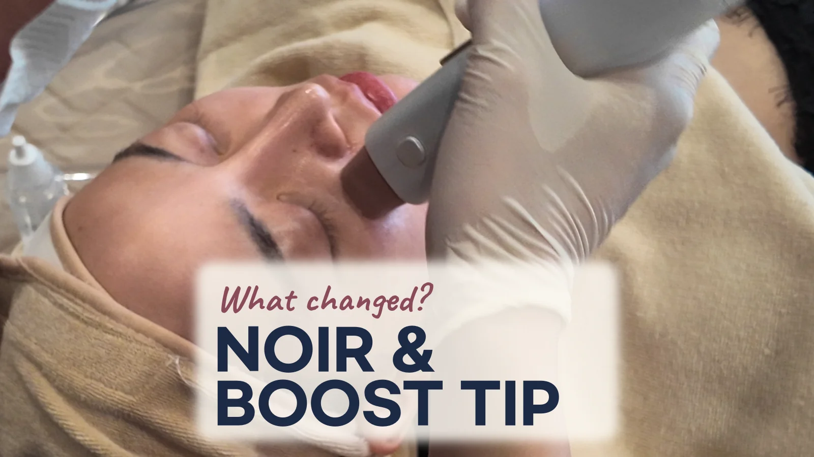 DENSITY Noir and Boost Tip: What Changed, and What Should You Confirm?