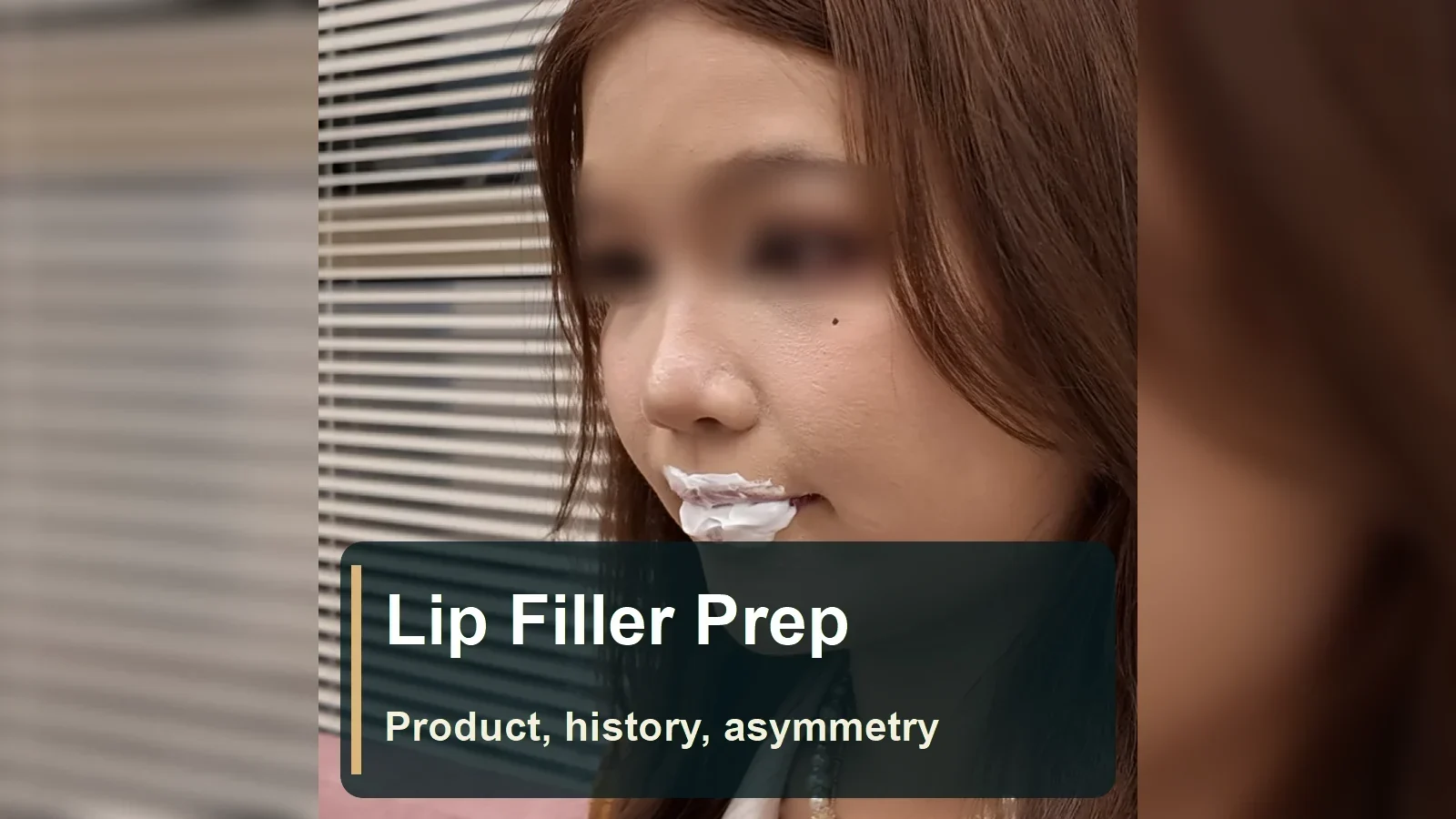 Lip Filler: Product Identity, Past Injections and Asymmetry Questions to Raise