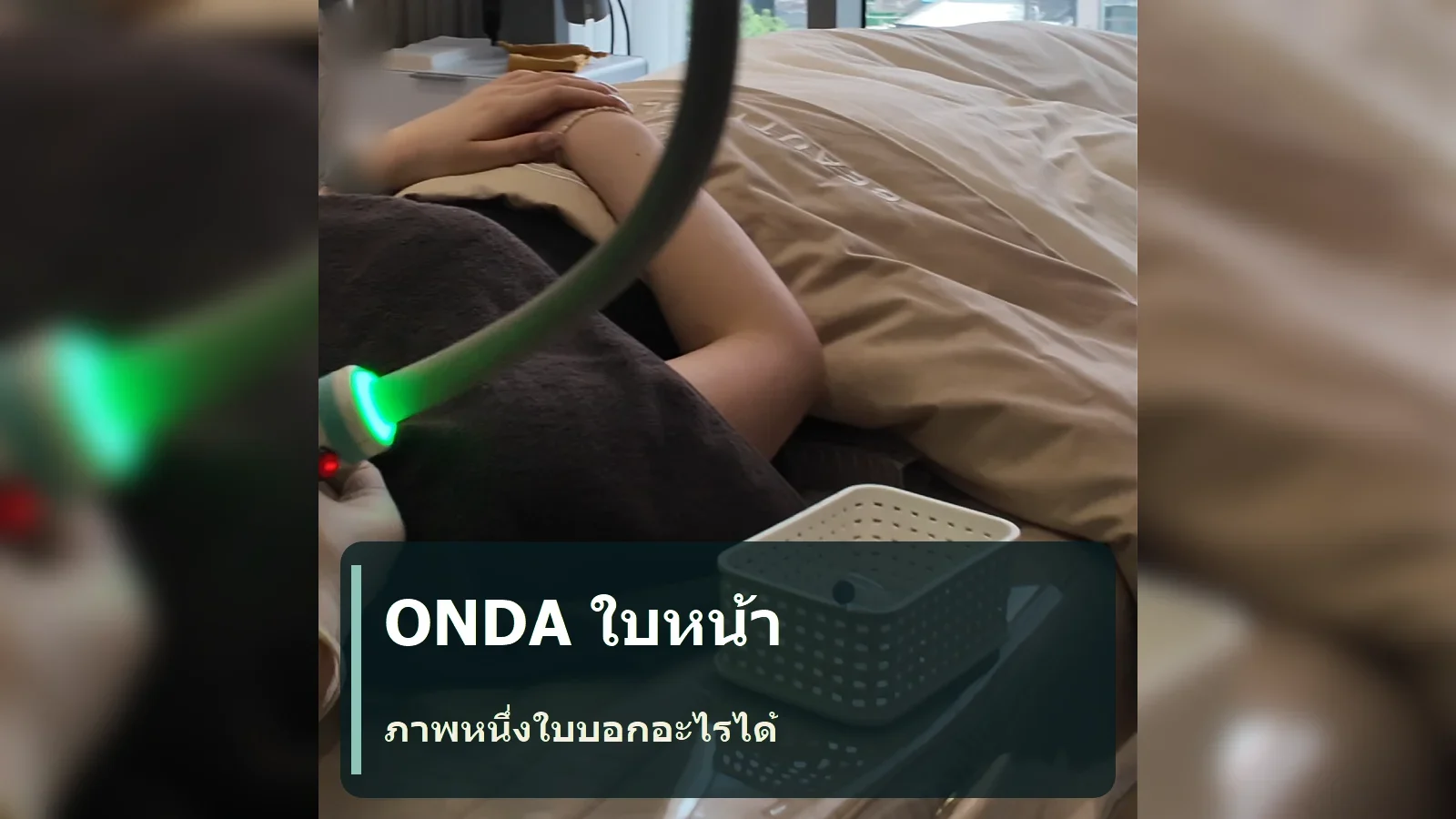 ภาพการรักษา ONDA บริเวณใบหน้า: เครื่อง หัวจับ และบริเวณที่ทำ บอกอะไรได้และบอกอะไรไม่ได้