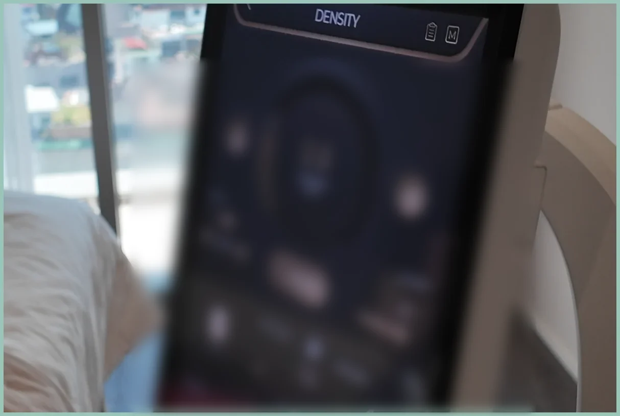 หน้าจอของเครื่อง Density ข้างเตียงในห้องทำหัตถการ เห็นชื่อ DENSITY ส่วนตัวเลขบนหน้าจอถูกเบลอ ไม่มีบุคคลในภาพ