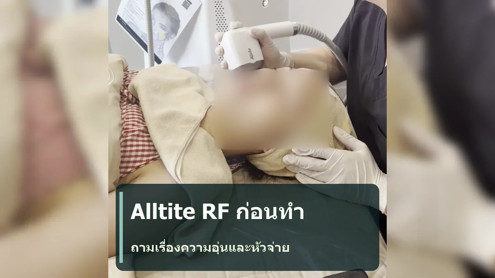 Alltite RF ก่อนทำ: ถามเรื่องความอุ่น หัวจ่าย และลำดับขั้นตอนอย่างไร