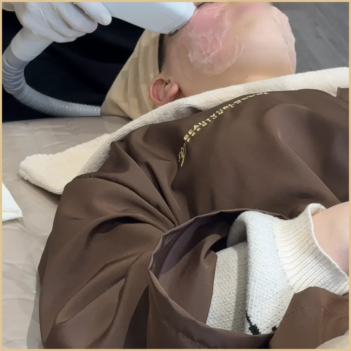 A gloved hand holds a treatment handpiece against a gel-covered cheek during a clinic session, with the staff face and most of the patient face out of frame