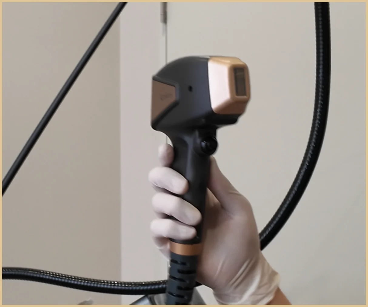 Gloved hand holding a laser handpiece with a gold band, cable arching overhead