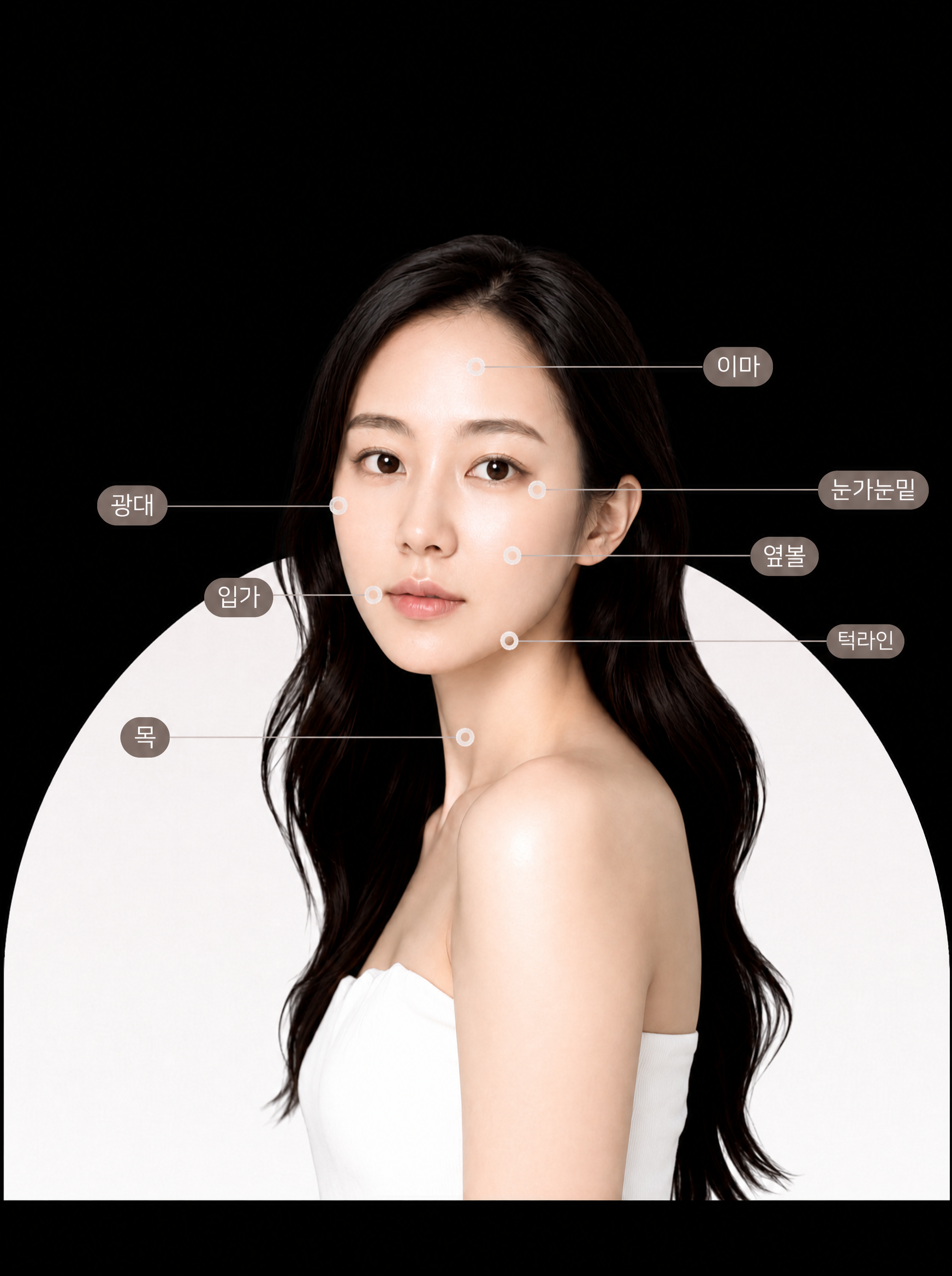 포트라 콰트로 시술 부위